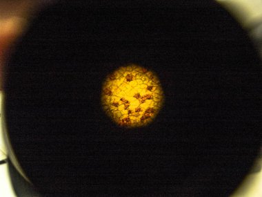 Soya yaprak görünümü mikroskop objektifinden üzerinde Asya pas (Phakopsora pachyrhizi)