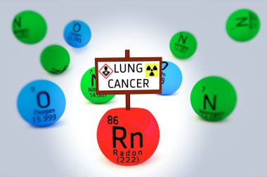 Radon 3D çizimi neden akciğer kanseri