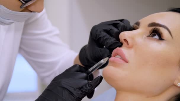 Ιατρικό γραφείο, γιατρός στο μαύρο αποστειρωμένα γάντια, έγχυση υαλουρονικού οξέος σε ασθενή χείλη. Διαδικασία για την αύξηση του όγκου των χειλιών, διόρθωση του σχήματος των χειλιών. — Αρχείο Βίντεο