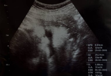x-ray görüntü beyin bilgisayarlı tomografi