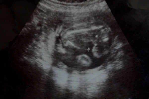x-ray görüntü beyin bilgisayarlı tomografi