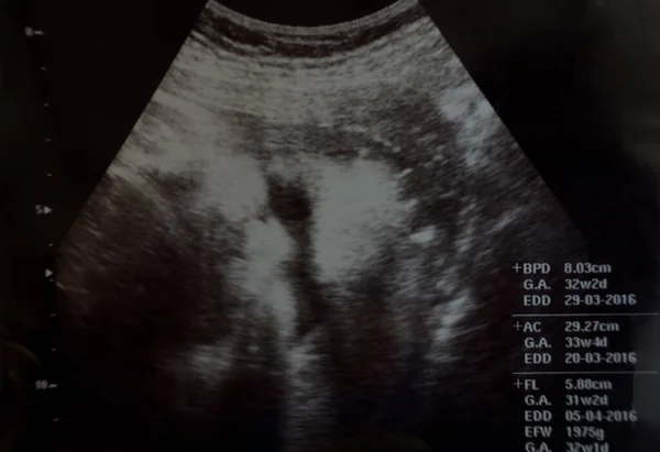 x-ray görüntü beyin bilgisayarlı tomografi