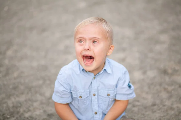 Vida Diária Uma Criança Com Deficiência Rapaz Com Síndrome Transtorno — Fotografia de Stock