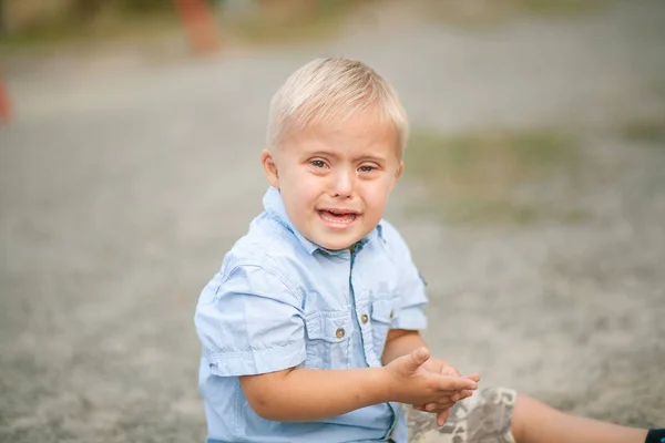 Daily Life Child Disabilities Boy Syndrome Chromosomal Genetic Disorder Baby — Stock Photo, Image