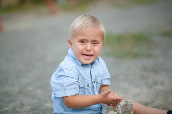 Καθημερινή Ζωή Ενός Παιδιού Αναπηρίες Ένα Αγόρι Σύνδρομο Ντάουν Χρωμοσωμική — Φωτογραφία Αρχείου