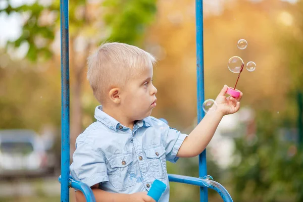 Vida Cotidiana Niño Con Discapacidad Niño Con Síndrome Está Jugando — Foto de Stock