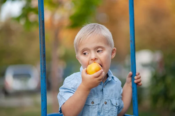 Vida Cotidiana Niño Con Discapacidad Niño Con Síndrome Está Jugando — Foto de Stock