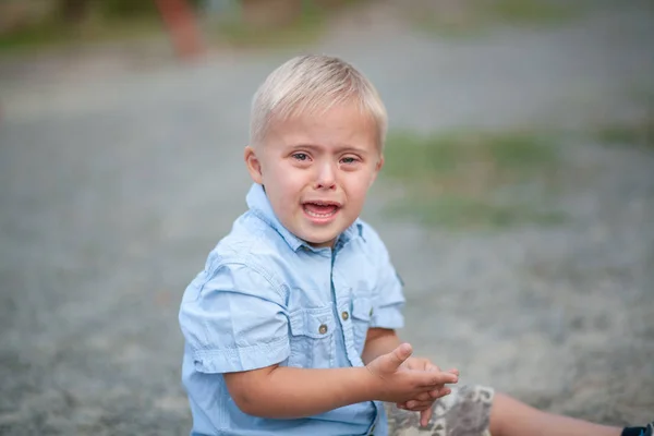 Fogyatékkal Élő Gyermek Mindennapi Élete Egy Szindrómás Fiú Kromoszóma Genetikai — Stock Fotó