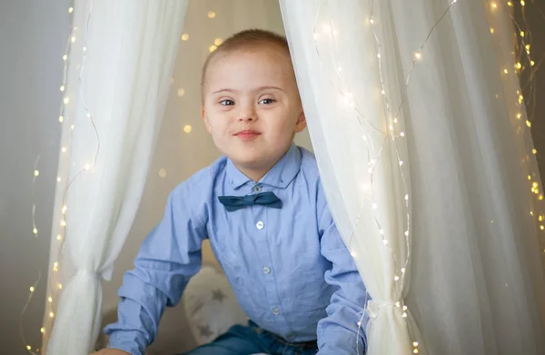 Portrait Garçon Atteint Syndrome Maladie Génétique Mentale Chez Enfant Handicapé — Photo