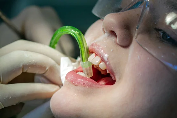 Une Fille Rendez Vous Chez Dentiste Inspection Cavité Buccale Des — Photo