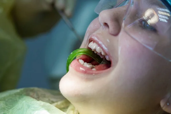 Une Fille Rendez Vous Chez Dentiste Inspection Cavité Buccale Des — Photo