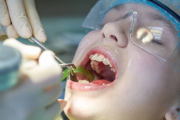 Une Fille Rendez Vous Chez Dentiste Inspection Cavité Buccale Des — Photo