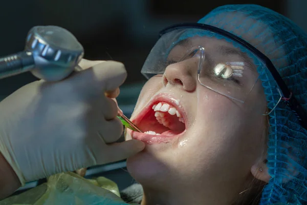 Une Fille Rendez Vous Chez Dentiste Inspection Cavité Buccale Des — Photo