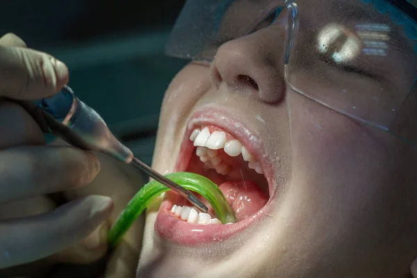 Dişçi Randevusundaki Kız Bir Çocuktaki Ağız Boşluğu Dişler Inceleniyor — Stok fotoğraf