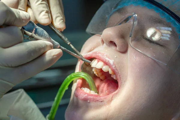 Une Fille Rendez Vous Chez Dentiste Inspection Cavité Buccale Des — Photo