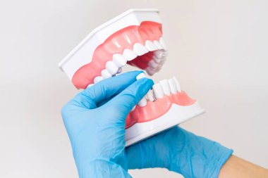 Beyaz dişli bir insan çenesinin yakın plan modeli. Mavi eldivenli kadın elleri alt çeneden bir diş çıkarır..