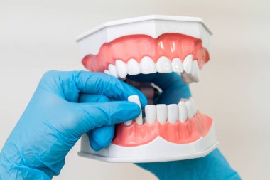 Beyaz dişli bir insan çenesinin yakın plan modeli. Mavi eldivenli kadın elleri alt çeneden bir diş çıkarır..