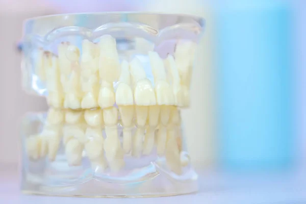 Transparent Model Human Jaw Permanent Deciduous Teeth — Stock Photo, Image