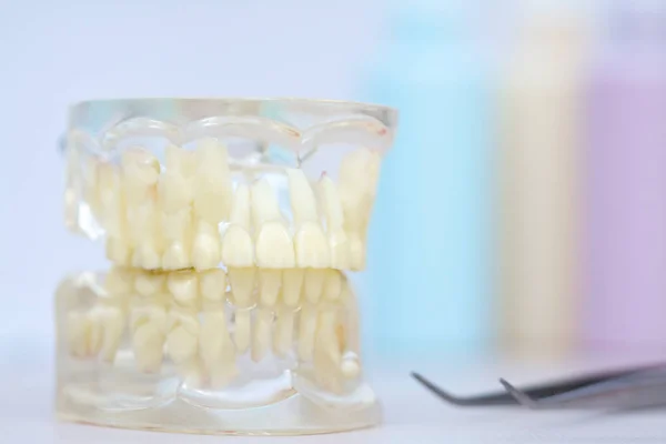 Modelo Transparente Mandíbula Humana Com Dentes Permanentes Decíduos — Fotografia de Stock