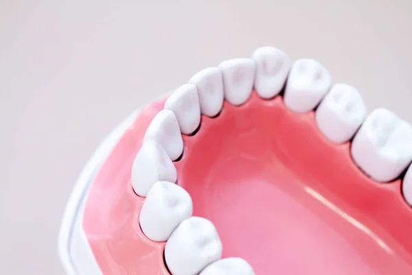 Zbliżenie Model Dentystyczny Białe Plastikowe Zęby Jasnym Pastelowym Tle Szczęka — Zdjęcie stockowe
