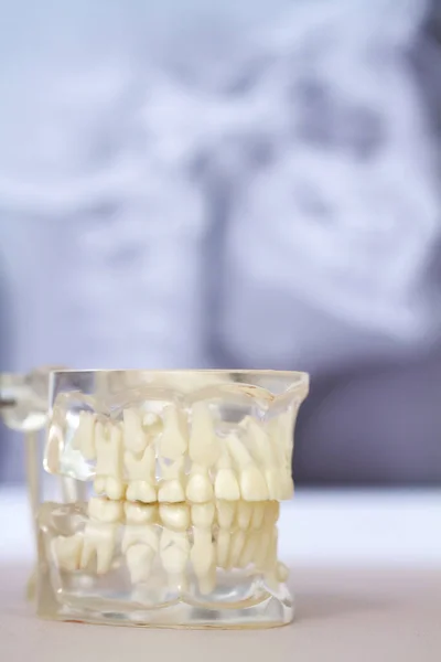 Transparent Model Human Jaw Permanent Deciduous Teeth — Stock Photo, Image