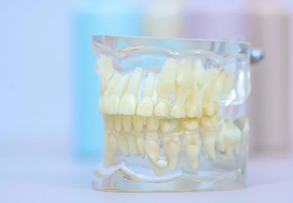 Modelo Transparente Mandíbula Humana Com Dentes Permanentes Decíduos — Fotografia de Stock