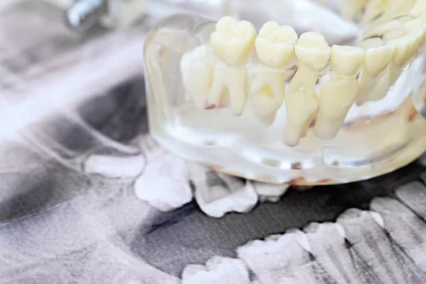 Transparent Model Human Lower Jaw Permanent Milk Teeth Light Pastel — Stock Photo, Image
