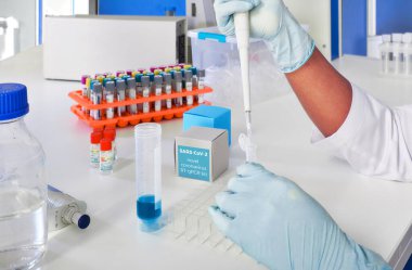 Roman Coronavirus 2019 nCoV RT-PCR tanı kiti. 2019-nCoV ya da covid19 virüsünü tespit etmek için reaksiyonlar, primerler ve kontrol örnekleri içeriyor. Gerçek zamanlı PCR analizi ile tüp bebek testlerinde.