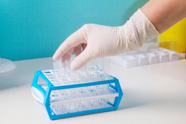 Yeni SARS-CoV-2 koronavirüs, test tüplerindeki numuneleri, nükleik asit testini, enfeksiyonu, test tüplerini, hasta örneklerini el ele verin. Coronavirüs Teşhis Aletleri