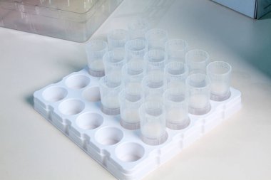 Yeni SARS-CoV-2 koronavirüs, test tüplerindeki örnekler, nükleik asit testi, enfeksiyon, test tüpleri, hasta örnekleri. Coronavirüs Teşhis Aletleri