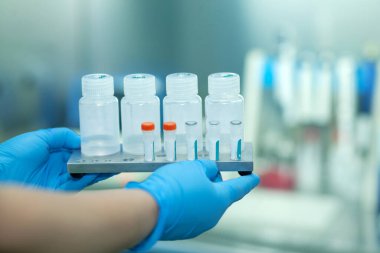 Yeni SARS-CoV-2 koronavirüs, test tüplerindeki numuneleri, nükleik asit testini, enfeksiyonu, test tüplerini, hasta örneklerini el ele verin. Coronavirüs Teşhis Aletleri