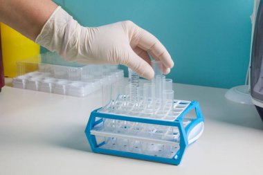 Yeni SARS-CoV-2 koronavirüs, test tüplerindeki numuneleri, nükleik asit testini, enfeksiyonu, test tüplerini, hasta örneklerini el ele verin. Coronavirüs Teşhis Aletleri