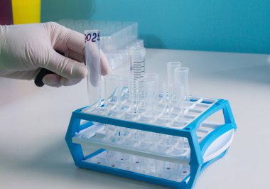 Yeni SARS-CoV-2 koronavirüs, test tüplerindeki numuneleri, nükleik asit testini, enfeksiyonu, test tüplerini, hasta örneklerini el ele verin. Coronavirüs Teşhis Aletleri