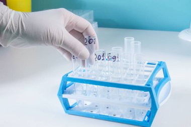 Yeni SARS-CoV-2 koronavirüs, test tüplerindeki numuneleri, nükleik asit testini, enfeksiyonu, test tüplerini, hasta örneklerini el ele verin. Coronavirüs Teşhis Aletleri