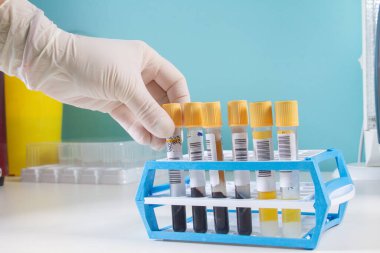 Eldiven içinde, tıp laboratuarındaki bilim adamı kan örneğini test tüpünde tutuyor. Test laboratuarında daha fazla kan ve idrar örneği alın. Yeni koronavirüs örnekleri üzerinde laboratuvar çalışması.