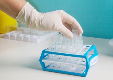 Yeni SARS-CoV-2 koronavirüs, test tüplerindeki numuneleri, nükleik asit testini, enfeksiyonu, test tüplerini, hasta örneklerini el ele verin. Coronavirüs Teşhis Aletleri