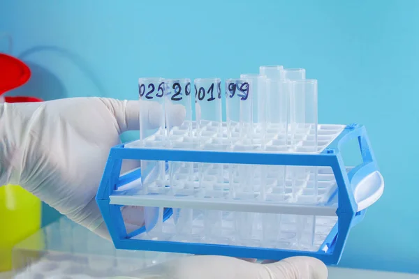 Νέο Sars Cov Coronavirus Χέρι Μάκτρο Κρατήσει Δείγματα Δοκιμαστικούς Σωλήνες — Φωτογραφία Αρχείου