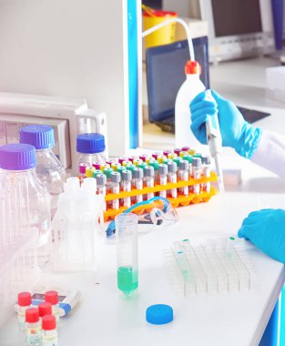 Genç Afrikalı kadın teknisyen ya da koruyucu gözlüklü bilim adamı test laboratuarında tıbbi kan örnekleriyle çalışıyor. SARS-Cov-2 virüsünden kaynaklanan viral pnömoni Covid-19 hastaları test ediliyor...