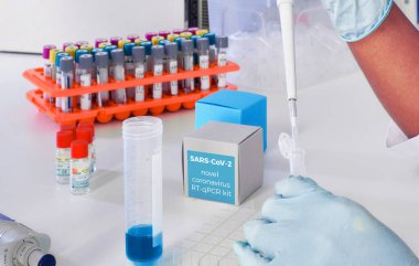 Roman Coronavirus 2019 nCoV RT-PCR tanı kiti. 2019-nCoV ya da covid19 virüsünü tespit etmek için reaksiyonlar, primerler ve kontrol örnekleri içeriyor. Gerçek zamanlı PCR analizi ile tüp bebek testlerinde.