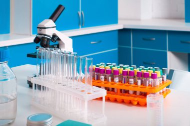 Laboratuvar içi, test laboratuvarı, viral zatürree olan hastalardan alınan kan örnekleri SARS-CoV-2 ve grip virüsleri için nükleik asitler ve virüslere karşı özel antikorlar için test edilecek..