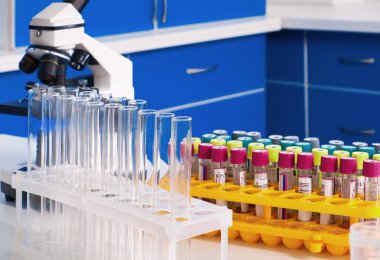 Laboratuvar içi, test laboratuvarı, viral zatürree olan hastalardan alınan kan örnekleri SARS-CoV-2 ve grip virüsleri için nükleik asitler ve virüslere karşı özel antikorlar için test edilecek..