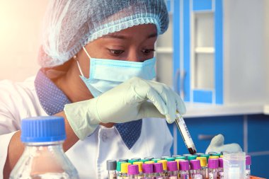 Afrikalı kadın teknisyen, teknik asistan, ağız örnekleriyle çalışıyor, Covid-19 'un tespiti için hasta örnekleri, SARS-CoV-2' nin yeni koronavirüsü. Tıbbi test laboratuarı, laboratuvar, test tesisi..