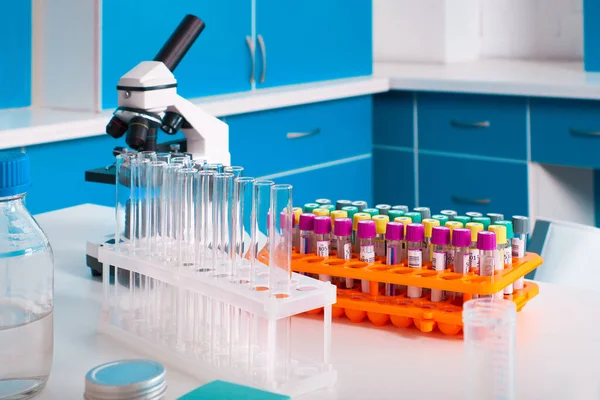 Laboratuvar içi, test laboratuvarı, viral zatürree olan hastalardan alınan kan örnekleri SARS-CoV-2 ve grip virüsleri için nükleik asitler ve virüslere karşı özel antikorlar için test edilecek..