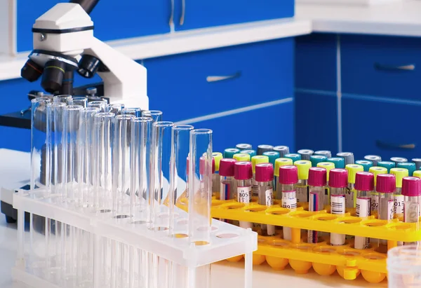 Laboratuvar içi, test laboratuvarı, viral zatürree olan hastalardan alınan kan örnekleri SARS-CoV-2 ve grip virüsleri için nükleik asitler ve virüslere karşı özel antikorlar için test edilecek..