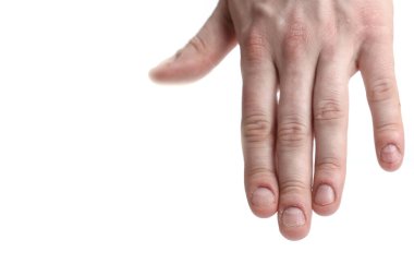 Tırnak hasarı. Tırnaklarını yemiş. Erkek manikürü. Tırnak tabağı sorunları. Erkek eli. Beyaz bir arkaplanda izole edilmiş.