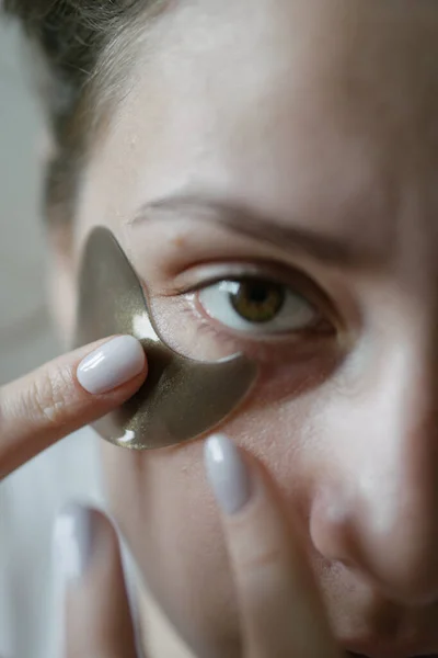 Applying a patch under the eye of a young woman close-up. Beauty and health, swollen skin under the eyes after a sleepless night — Stock Photo, Image
