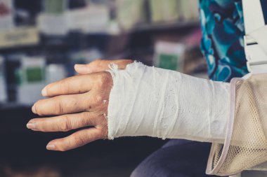 Bir kırık bilek ya da çatlamak el kemikleri içinde.