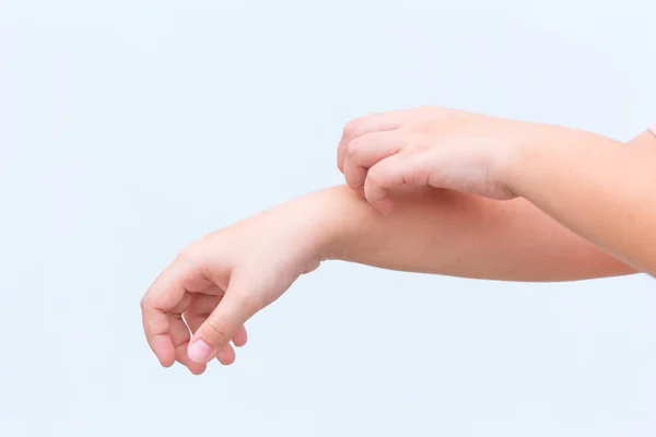 Picazón en la piel con rascarse la mano sobre fondo blanco —  Fotos de Stock