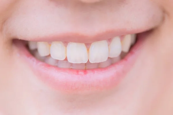 Closeup boca bom sorriso dental com dentes brancos saudáveis — Fotografia de Stock