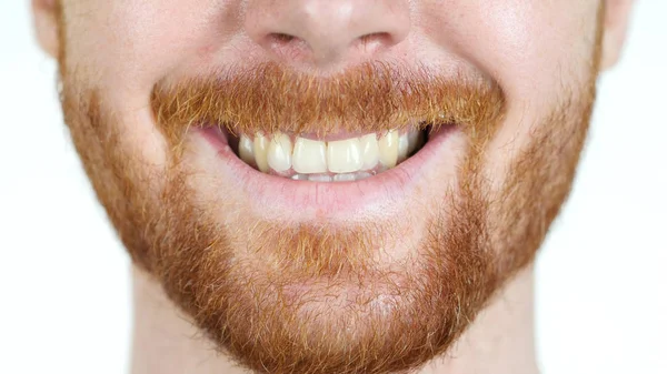 Imagen detallada del joven sonriendo con dientes blancos perfectos —  Fotos de Stock